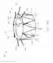 Fig. 45 - Implantable device and delivery system for reshaping a heart valve annulus