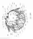 Fig. 46 - Implantable device and delivery system for reshaping a heart valve annulus