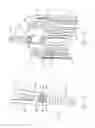 Fig. 65 - Implantable device and delivery system for reshaping a heart valve annulus