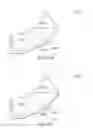 Fig. 09 - High X-Ray Lucency Lattice Structures