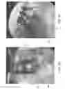 Fig. 28 - Methods of designing high x-ray lucency lattice structures