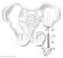 Fig. 01 - Acetabular surgical implant for segmental pelvic defect and methods of use and manufacture