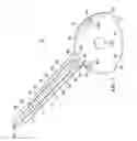 Fig. 02 - Acetabular surgical implant for segmental pelvic defect and methods of use and manufacture