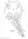 Fig. 07 - Acetabular surgical implant for segmental pelvic defect and methods of use and manufacture