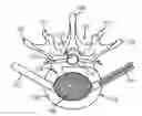 Fig. 01 - Coiling implantable prostheses