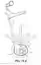 Fig. 32 - Coiling implantable prostheses