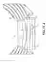 Fig. 40 - Coiling implantable prostheses