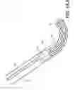 Fig. 52 - Coiling implantable prostheses