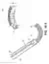 Fig. 53 - Coiling implantable prostheses