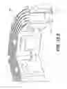 Fig. 64 - Coiling implantable prostheses