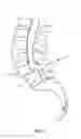 Fig. 02 - Surgical system and method of use