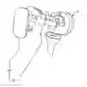 Fig. 01 - Surgical impactor/extractor assembly and method of use