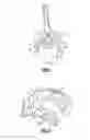 Fig. 07 - Surgical impactor/extractor assembly and method of use