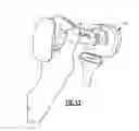 Fig. 09 - Surgical impactor/extractor assembly and method of use