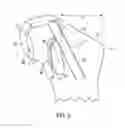 Fig. 07 - Bone preserving intraoperative downsizing system for orthopaedic implants
