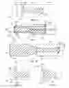 Fig. 04 - Self-Expanding Bridging Stent with Anchoring Projections and Methods for Use