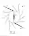 Fig. 03 - Crimping methods for thin-walled scaffolds