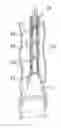 Fig. 01 - Devices and Methods for Anchoring an Endoluminal Sleeve in the GI Tract
