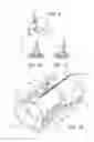 Fig. 04 - Devices and Methods for Anchoring an Endoluminal Sleeve in the GI Tract