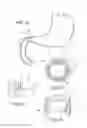 Fig. 05 - Devices and Methods for Anchoring an Endoluminal Sleeve in the GI Tract