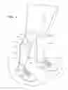 Fig. 02 - LEG COMPRESSION SLEEVE WITH INSERT FOR SHIN SPLINTS