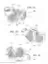 Fig. 03 - Orthopedic device, method, and system for making an orthopedic device