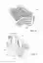 Fig. 06 - Orthopedic device, method, and system for making an orthopedic device