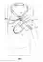 Fig. 07 - Hand elevation device and methods of use