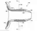 Fig. 01 - External penile erection system