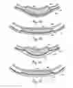Fig. 06 - External penile erection system