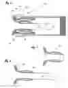 Fig. 05 - INFLATABLE PENILE VACUUM APPARATUS