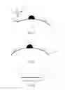 Fig. 04 - Base plate of an ostomy appliance