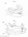 Fig. 02 - Device for moving lower jaw forward