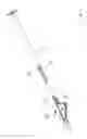 Fig. 05 - DEVICE FOR HOLDING FOLDING AND INJECTING AN INTRAOCULAR LENS