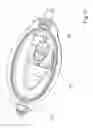 Fig. 13 - DEVICE FOR HOLDING FOLDING AND INJECTING AN INTRAOCULAR LENS