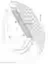 Fig. 07 - Dressing with variable contraction zones