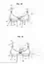 Fig. 08 - Methods for absorbing moisture around breasts