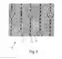 Fig. 04 - Apertured webs and methods for making the same