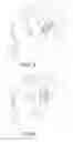 Fig. 05 - MEIBOMIAN GLAND MANUAL MASSAGE DEVICE AND METHOD OF USE
