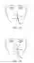 Fig. 04 - Nasogastric tube securement systems and methods of using same