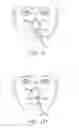 Fig. 05 - Nasogastric tube securement systems and methods of using same