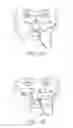 Fig. 06 - Nasogastric tube securement systems and methods of using same