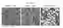 Fig. 01 - Agent for conditioning dentin and enamel