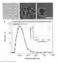 Fig. 01 - Mesoporous calcium phosphate-citrate nanoparticles and uses thereof