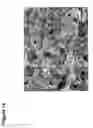 Fig. 18 - Mesoporous calcium phosphate-citrate nanoparticles and uses thereof