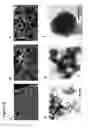 Fig. 22 - Mesoporous calcium phosphate-citrate nanoparticles and uses thereof