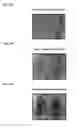 Fig. 05 - Reduction of adipose tissue