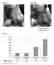 Fig. 06 - Reduction of adipose tissue