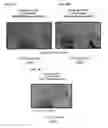 Fig. 08 - Reduction of adipose tissue