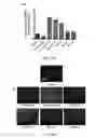 Fig. 43 - COMPOUNDS AND METHODS OF PROMOTING MYELINATION